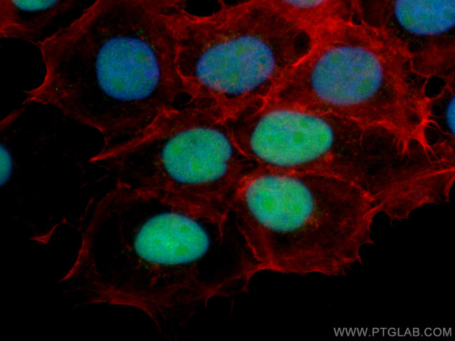 DBR1 Antibody in Immunocytochemistry (ICC/IF)