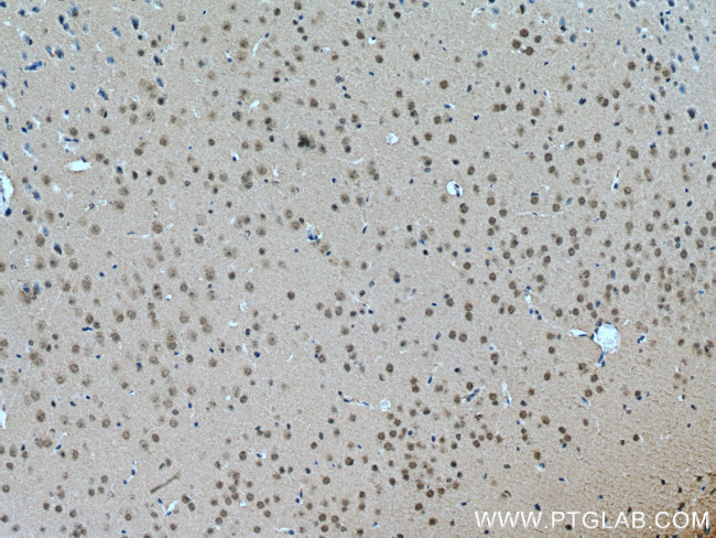 DBR1 Antibody in Immunohistochemistry (Paraffin) (IHC (P))