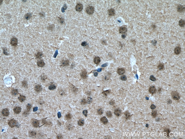 DBR1 Antibody in Immunohistochemistry (Paraffin) (IHC (P))