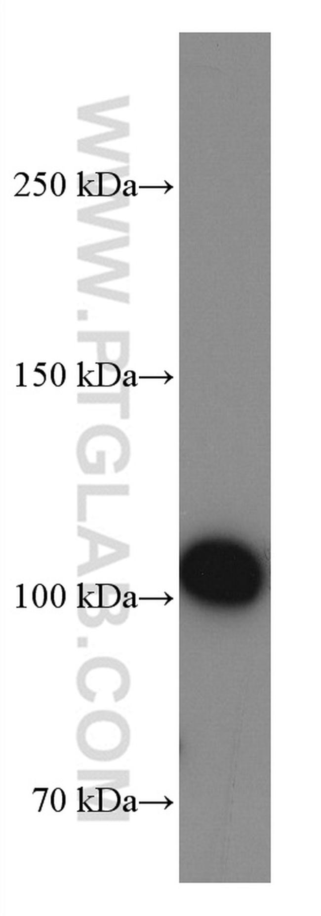 Integrin Beta 3 Antibody in Western Blot (WB)