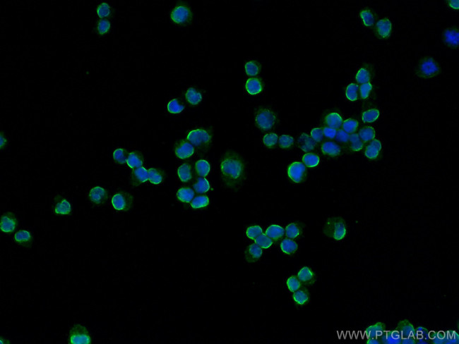 BLNK Antibody in Immunocytochemistry (ICC/IF)