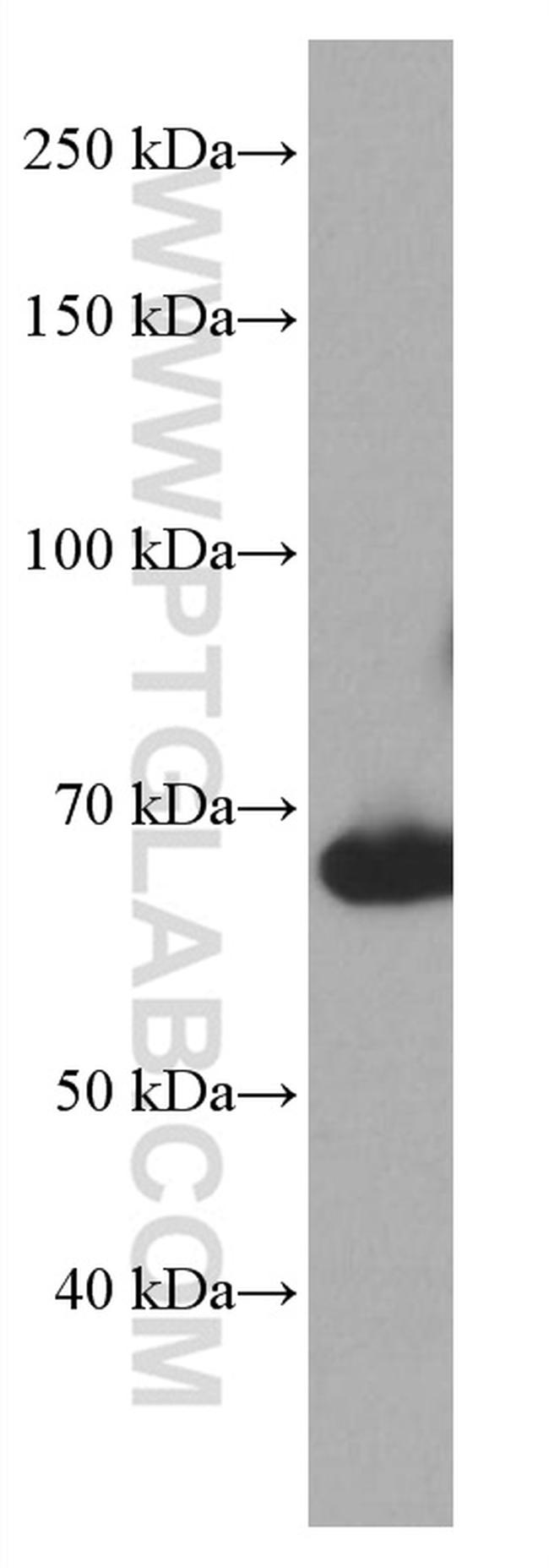 BLNK Antibody in Western Blot (WB)