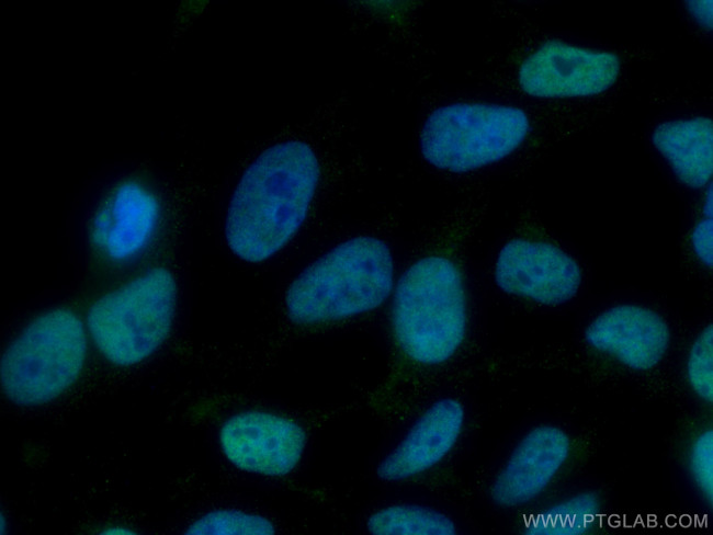 TBL1X Antibody in Immunocytochemistry (ICC/IF)