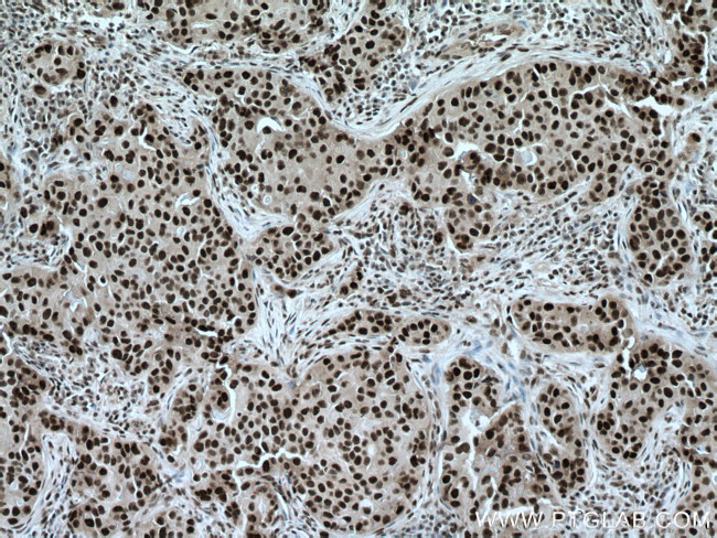 TBL1X Antibody in Immunohistochemistry (Paraffin) (IHC (P))