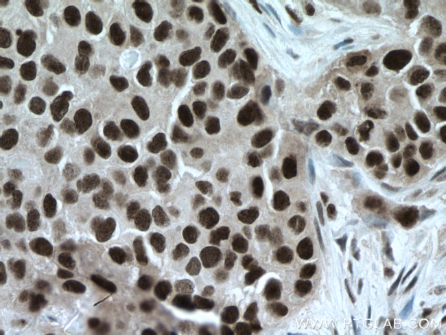 TBL1X Antibody in Immunohistochemistry (Paraffin) (IHC (P))