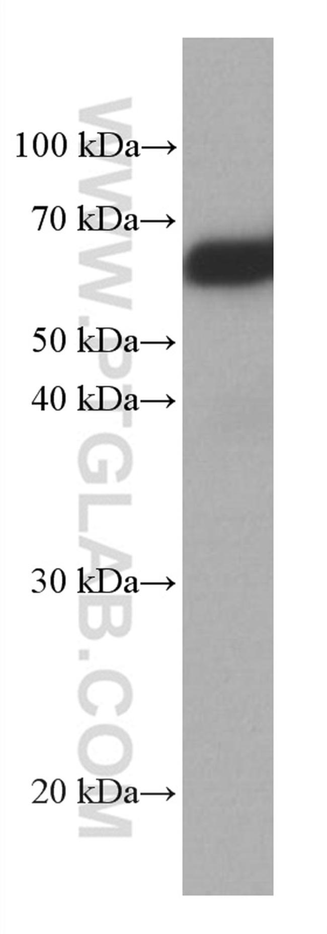 TBL1X Antibody in Western Blot (WB)