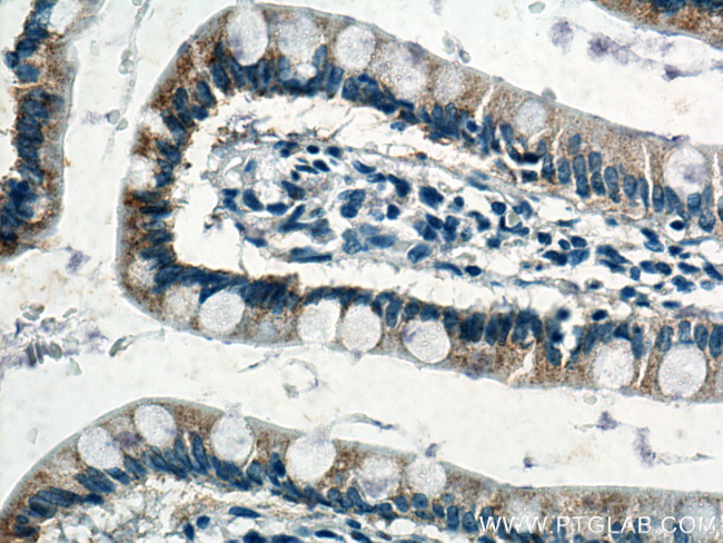 NOTUM Antibody in Immunohistochemistry (Paraffin) (IHC (P))