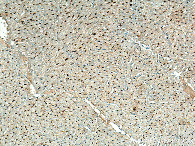 LXN Antibody in Immunohistochemistry (Paraffin) (IHC (P))