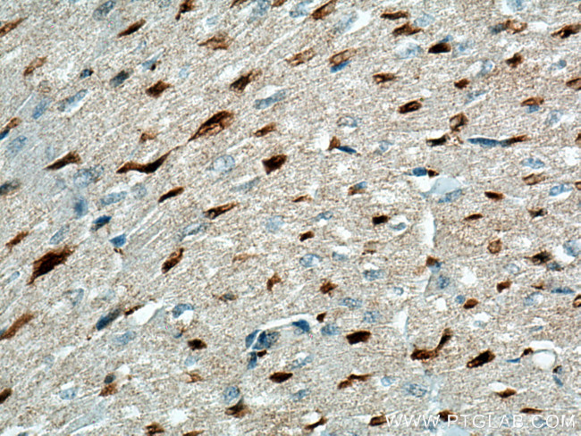 LXN Antibody in Immunohistochemistry (Paraffin) (IHC (P))