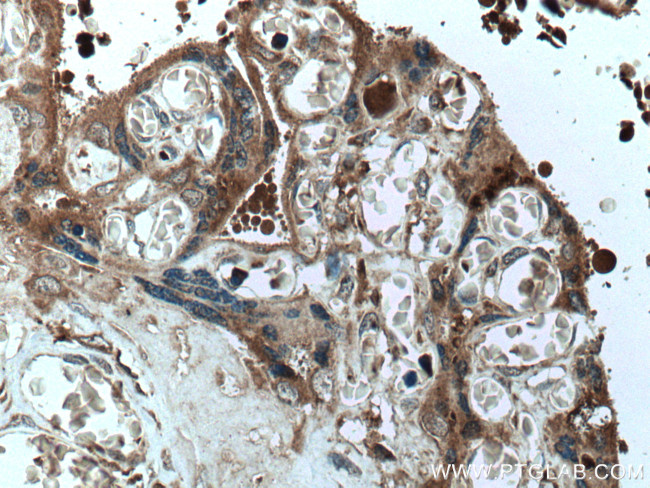 PAPPA Antibody in Immunohistochemistry (Paraffin) (IHC (P))