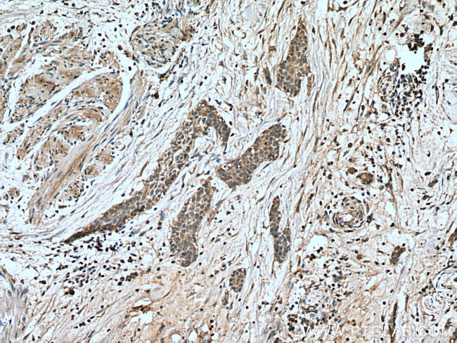 NFATC1 Antibody in Immunohistochemistry (Paraffin) (IHC (P))