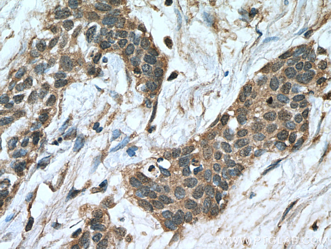 NFATC1 Antibody in Immunohistochemistry (Paraffin) (IHC (P))