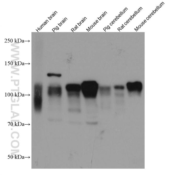 NLGN1 Antibody in Western Blot (WB)