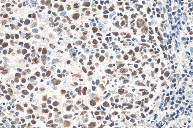 IKZF1 Antibody in Immunohistochemistry (Paraffin) (IHC (P))