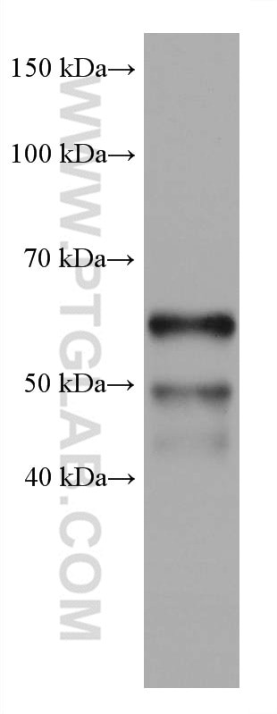 IKZF1 Antibody in Western Blot (WB)