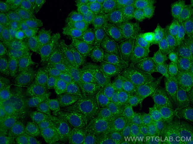 PARD3 Antibody in Immunocytochemistry (ICC/IF)