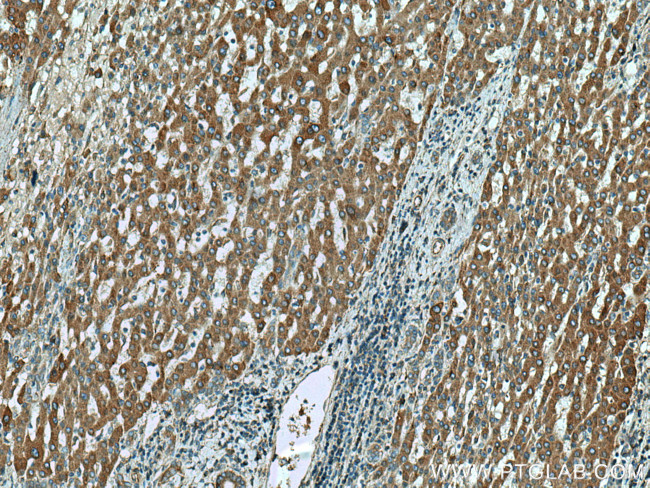 DOCK2 Antibody in Immunohistochemistry (Paraffin) (IHC (P))