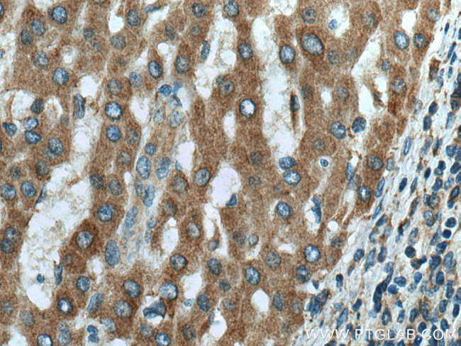 DOCK2 Antibody in Immunohistochemistry (Paraffin) (IHC (P))