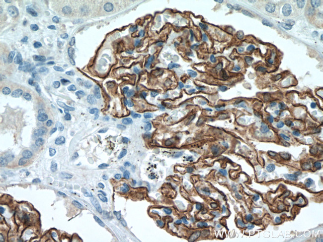 Nephrin Antibody in Immunohistochemistry (Paraffin) (IHC (P))