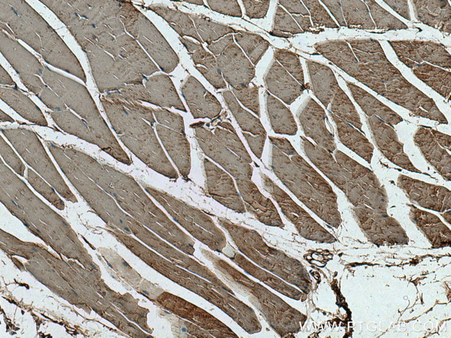 HK2 Antibody in Immunohistochemistry (Paraffin) (IHC (P))