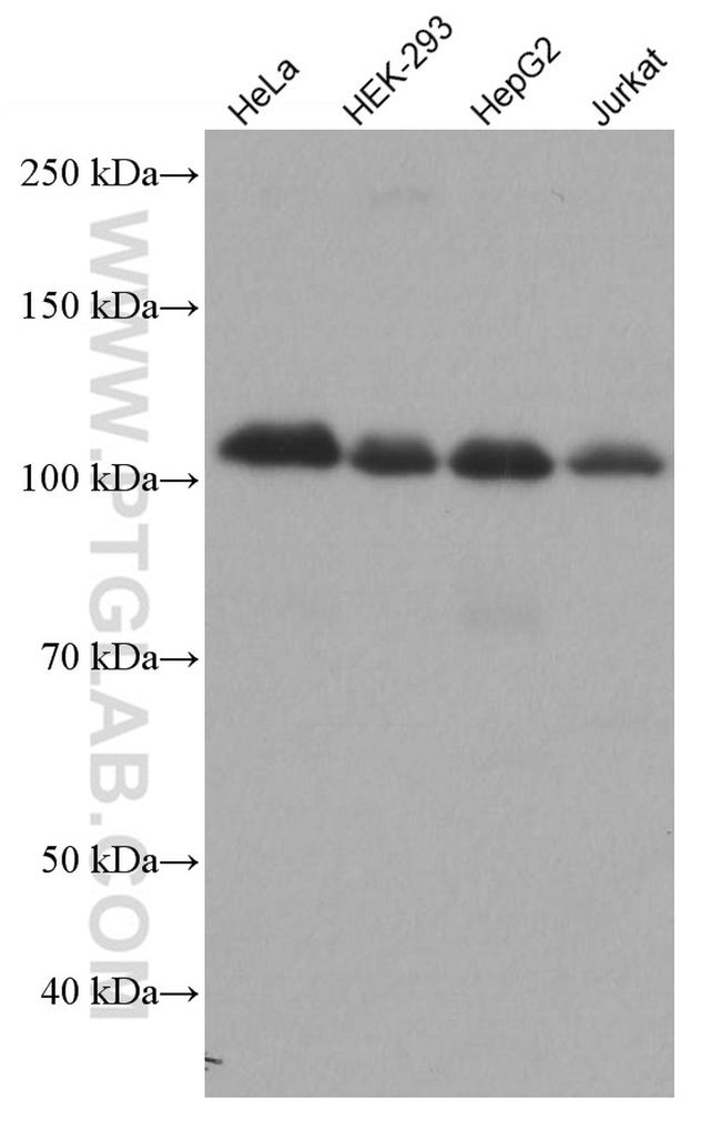 HK2 Antibody in Western Blot (WB)