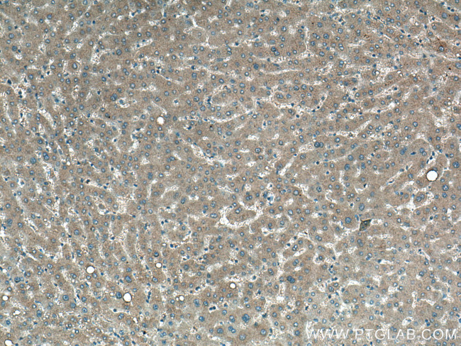 EPO Antibody in Immunohistochemistry (Paraffin) (IHC (P))