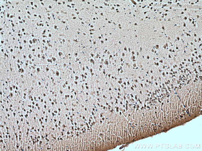 FOX2/RBM9 Antibody in Immunohistochemistry (Paraffin) (IHC (P))