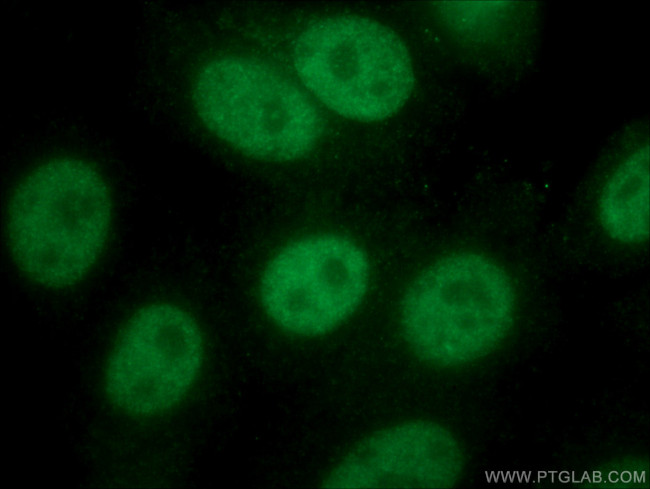 NBN Antibody in Immunocytochemistry (ICC/IF)