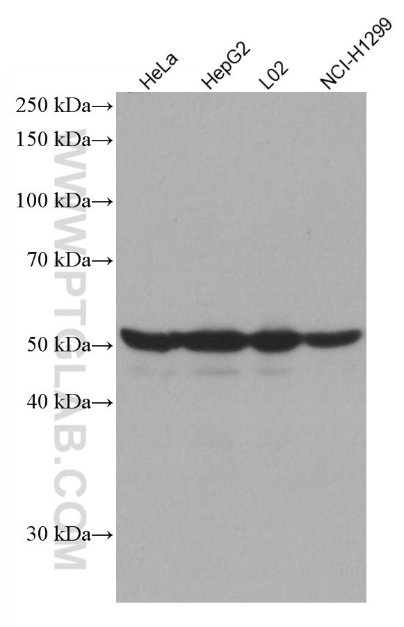 EPHX1 Antibody in Western Blot (WB)