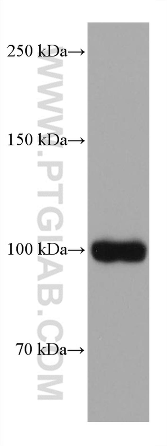 TRPV1 Antibody in Western Blot (WB)