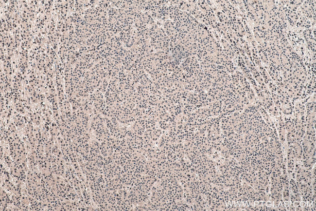 FBL Antibody in Immunohistochemistry (Paraffin) (IHC (P))