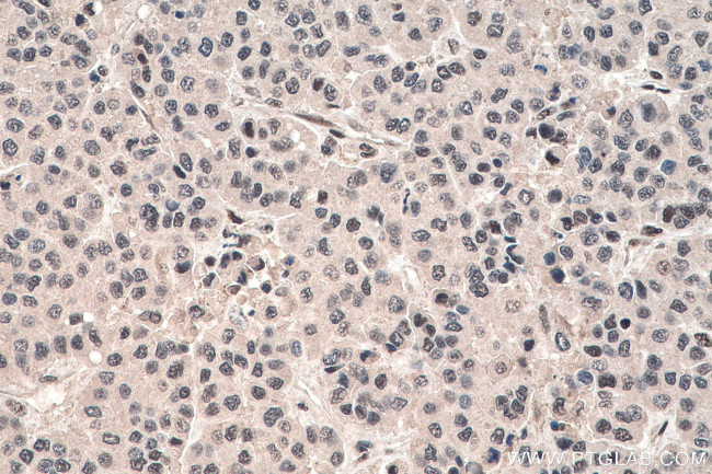 FBL Antibody in Immunohistochemistry (Paraffin) (IHC (P))