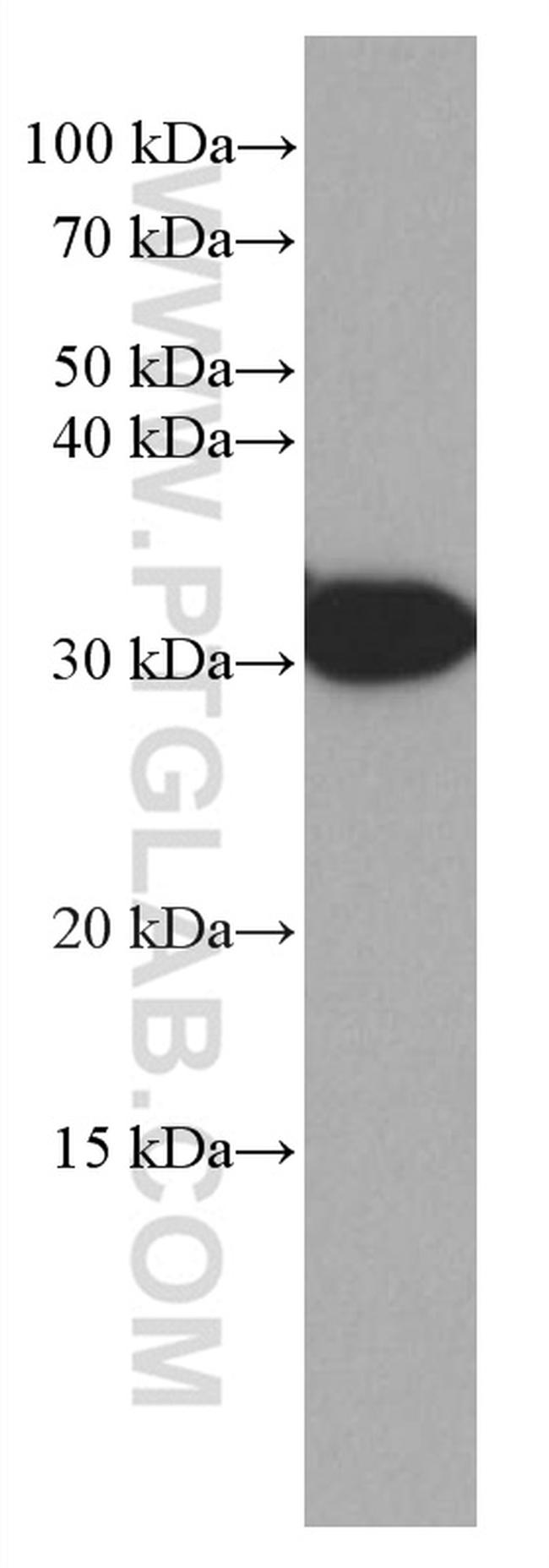 LHPP Antibody in Western Blot (WB)