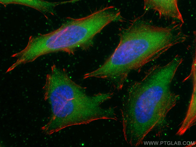 hIST1 Antibody in Immunocytochemistry (ICC/IF)