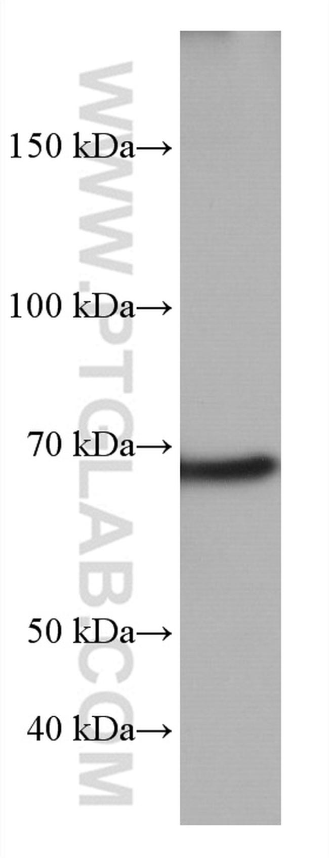 TP73 Antibody in Western Blot (WB)