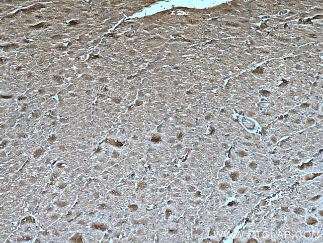 UBAP1 Antibody in Immunohistochemistry (Paraffin) (IHC (P))