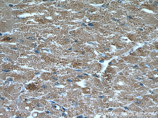 UBAP1 Antibody in Immunohistochemistry (Paraffin) (IHC (P))