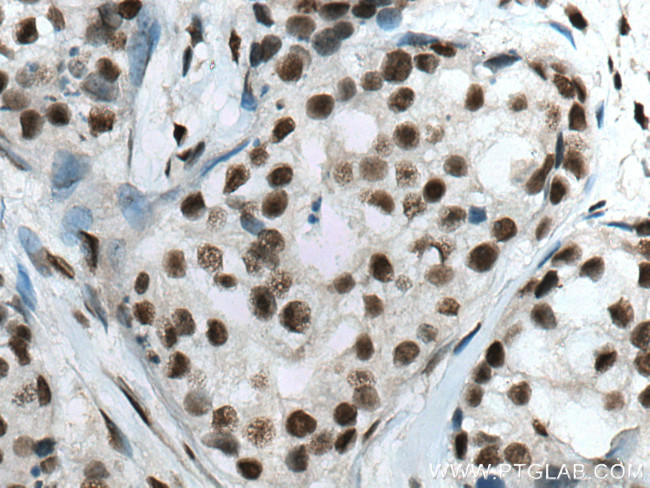 CTBP1 Antibody in Immunohistochemistry (Paraffin) (IHC (P))