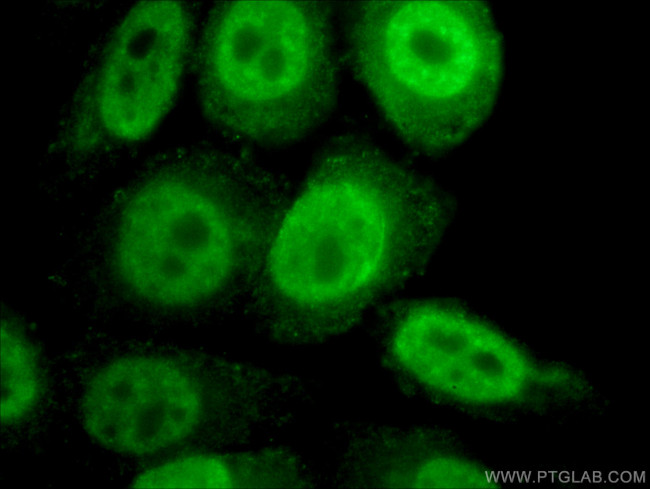 RAG2 Antibody in Immunocytochemistry (ICC/IF)