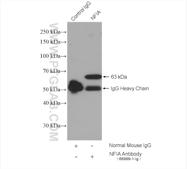 NFIA Antibody in Immunoprecipitation (IP)