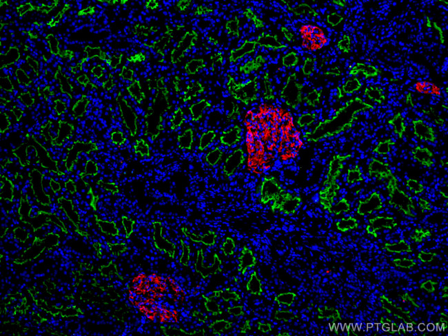 PTPRO Antibody in Immunohistochemistry (Paraffin) (IHC (P))