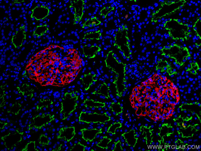 PTPRO Antibody in Immunohistochemistry (Paraffin) (IHC (P))