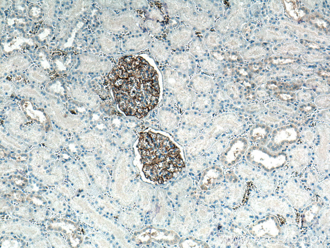 PTPRO Antibody in Immunohistochemistry (Paraffin) (IHC (P))