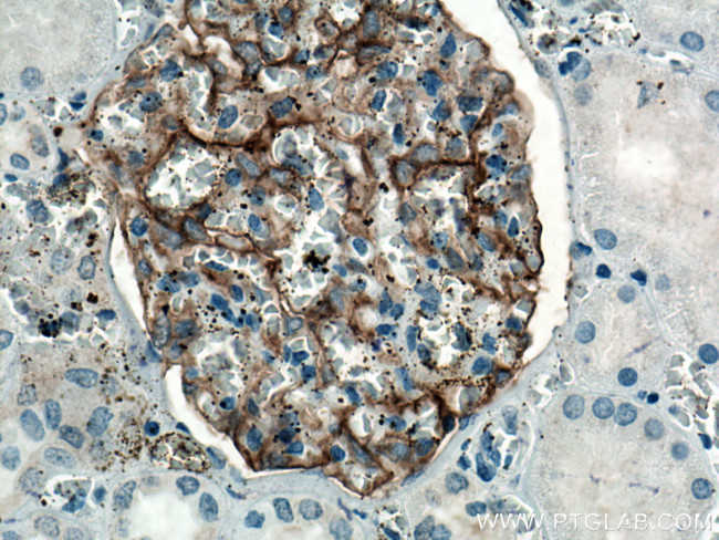 PTPRO Antibody in Immunohistochemistry (Paraffin) (IHC (P))