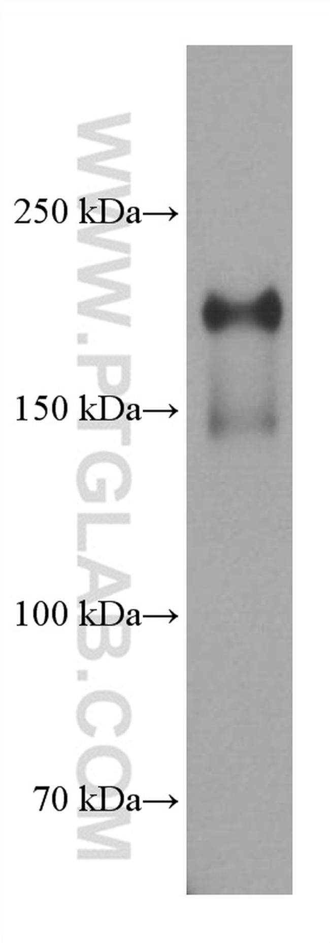 PTPRO Antibody in Western Blot (WB)