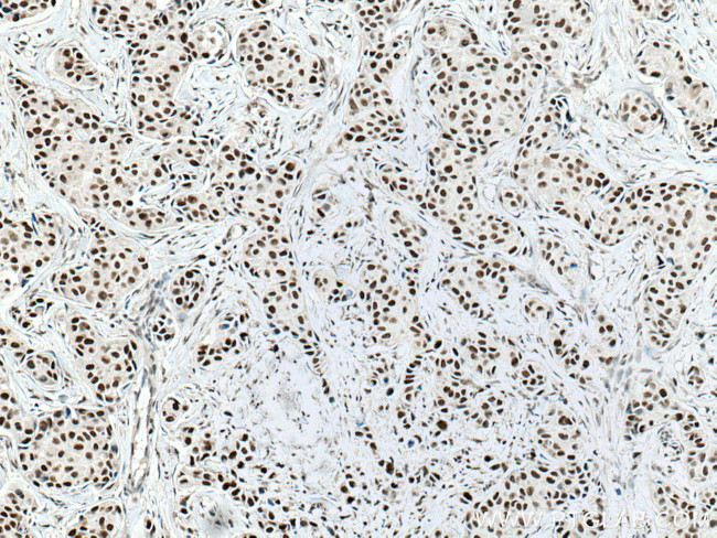 NUP50 Antibody in Immunohistochemistry (Paraffin) (IHC (P))