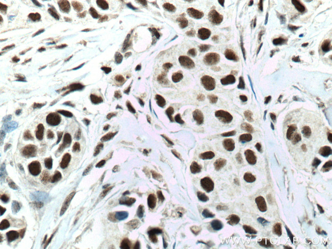 NUP50 Antibody in Immunohistochemistry (Paraffin) (IHC (P))