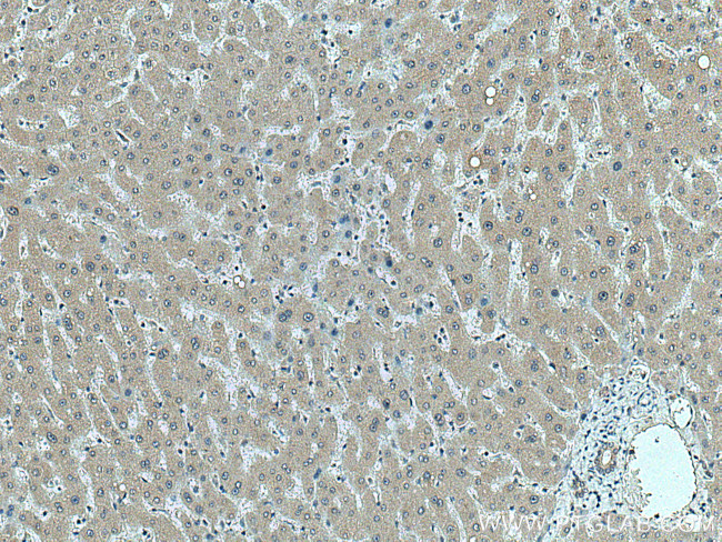 fetuin-B Antibody in Immunohistochemistry (Paraffin) (IHC (P))