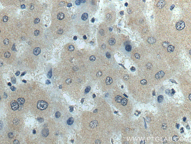 fetuin-B Antibody in Immunohistochemistry (Paraffin) (IHC (P))