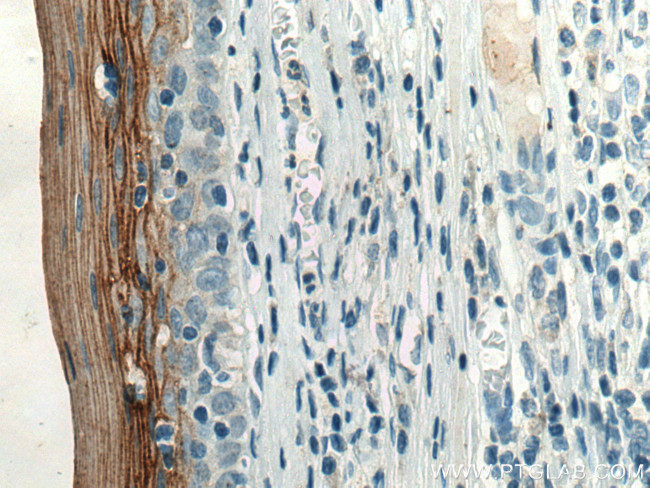 TGM1 Antibody in Immunohistochemistry (Paraffin) (IHC (P))